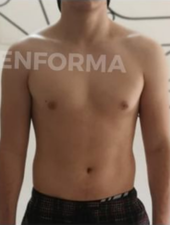 Avance del proceso de Juan