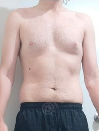 Inicio del proceso de Luis